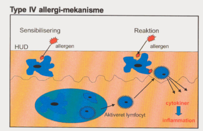 Type IV allergi-mekanisme